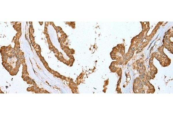 ALKBH8 antibody