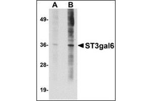 Western blot analysis of ST3gal6 in HeLa cell lysate with this product at (A) 1 and (B) 2 μg/ml. (ST3GAL6 antibody  (C-Term))