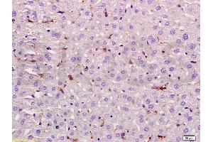 Formalin-fixed and paraffin embedded rat liver labeled with Rabbit Anti LIF Polyclonal Antibody, Unconjugated (ABIN737046) at 1:200 followed by conjugation to the secondary antibody and DAB staining (LIF antibody  (AA 101-202))