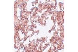 Immunohistochemistry of PLEKHM3 in human brain tissue with AP30330PU-N PLEKHM3 antibody at 5 μg/ml. (FAM59A antibody  (C-Term))