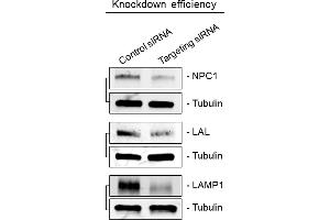 Immunoblots showing knockdown efficiency of siRNA transfections related to Figure 3A. (Lipase A antibody  (Center))