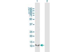 Western Blot analysis of RBP5 expression in transfected 293T cell line by RBP5 MaxPab polyclonal antibody. (Retinol Binding Protein 5 antibody  (AA 1-135))