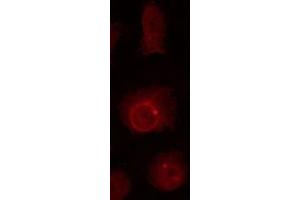 ABIN6267023 staining HuvEc by IF/ICC. (Nibrin antibody  (pSer278))