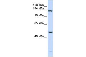 ADAMTS18 antibody used at 1 ug/ml to detect target protein. (ADAMTS18 antibody  (N-Term))
