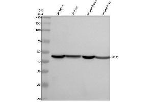Western blot analysis of PDK1 using anti-PDK1 antibody (ABIN7605897).