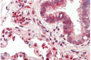 Human, Lung: Formalin-Fixed Paraffin-Embedded (FFPE) (P4HB antibody  (C-Term))