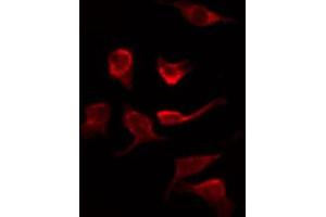 ABIN6267279 staining Hela by IF/ICC. (RAF1 antibody  (pSer621))