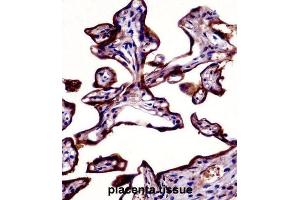 Immunohistochemistry (IHC) image for anti-Placental Alkaline Phosphatase (ALPP) antibody (ABIN2998362)