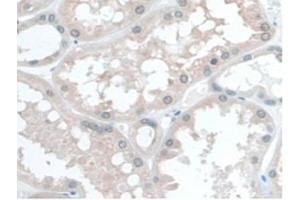 IHC-P analysis of Human Kidney Tissue, with DAB staining. (COQ6 antibody  (AA 1-468))