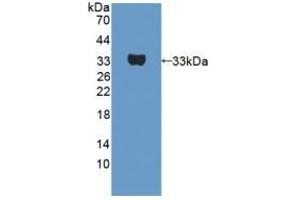 Detection of Recombinant UTRN, Human using Polyclonal Antibody to Utrophin (UTRN) (Utrophin antibody  (AA 1-252))