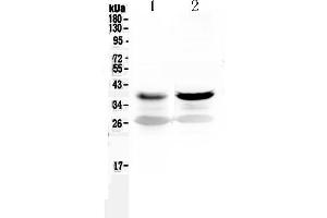 Western blot analysis of MEK6 using anti-MEK6 antibody .