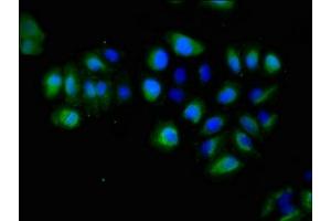Immunofluorescent analysis of A549 cells using ABIN7151843 at dilution of 1:100 and Alexa Fluor 488-congugated AffiniPure Goat Anti-Rabbit IgG(H+L) (EPH Receptor A5 antibody  (AA 246-514))