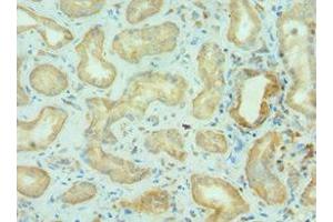 Immunohistochemistry of paraffin-embedded human kidney tissue using ABIN7145825 at dilution of 1:100 (BRD9 antibody  (AA 338-597))