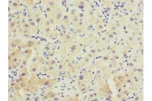 Immunohistochemistry of paraffin-embedded human liver tissue using ABIN7153137 at dilution of 1:100 (FHL3 antibody  (AA 1-280))