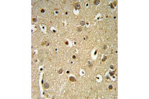 SPRY4-Y75 Antibody (ABIN652338 and ABIN2841560) IHC analysis in formalin fixed and paraffin embedded brain tissue followed by peroxidase conjugation of the secondary antibody and DAB staining.