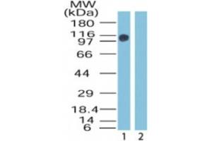 Western Blotting (WB) image for anti-Zinc Finger, MYM-Type 2 (ZMYM2) (AA 1250-1300) antibody (ABIN2469808) (ZMYM2 antibody  (AA 1250-1300))