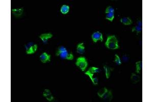 Immunofluorescence staining of MCF-7 cells with ABIN7152978 at 1:266, counter-stained with DAPI.