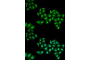 Immunofluorescence (IF) image for anti-DEAD (Asp-Glu-Ala-Asp) Box Polypeptide 1 (DDX1) antibody (ABIN1980256) (DDX1 antibody)