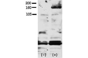 Western blot testing of phospho-HER4 antibody and FG pancreatic carcinoma cells treated with or without EGF (50ng/ml) for 15 min.