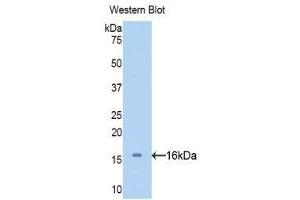 Western Blotting (WB) image for anti-serpin Peptidase Inhibitor, Clade A (Alpha-1 Antiproteinase, Antitrypsin), Member 6 (SERPINA6) (AA 280-405) antibody (ABIN1858268) (SERPINA6 antibody  (AA 280-405))