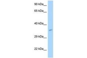 Image no. 1 for anti-Mitochondrial Ribosomal Protein L3 (MRPL3) (AA 32-81) antibody (ABIN6747361) (MRPL3 antibody  (AA 32-81))