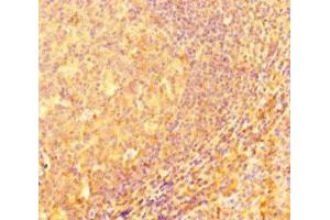 Immunohistochemistry of paraffin-embedded human tonsil tissue using ABIN7156623 at dilution of 1:100 (IRF5 antibody  (AA 214-395))