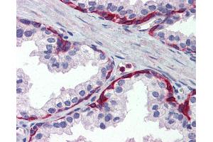 Anti-METTL7A antibody IHC of human prostate. (METTL7A antibody  (Internal Region))