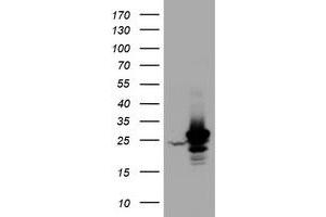 Western Blotting (WB) image for anti-Hydroxysteroid (17-Beta) Dehydrogenase 8 (HSD17B8) (AA 57-261) antibody (ABIN2715557) (HSD17B8 antibody  (AA 57-261))