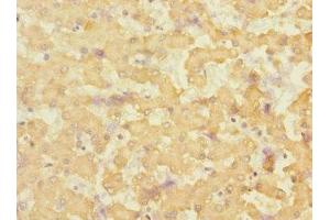 Immunohistochemistry of paraffin-embedded human liver tissue using ABIN7151880 at dilution of 1:100 (Ephrin B3 antibody  (AA 28-226))
