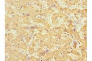 Immunohistochemistry of paraffin-embedded human liver tissue using ABIN7151880 at dilution of 1:100