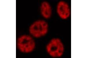 ABIN6267596 staining HeLa by IF/ICC. (NF-kB p65 antibody  (pSer276))