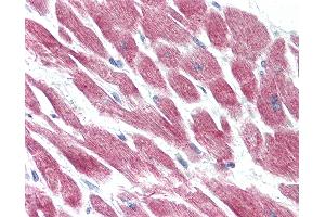 Anti-GPR15 antibody IHC of human heart. (GPR15 antibody  (Extracellular Domain))