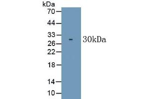 Detection of Recombinant CD226, Human using Monoclonal Antibody to Cluster Of Differentiation 226 (CD226) (CD226 antibody  (AA 19-254))