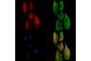 Phospho-PKC theta (Ser695) Antibody staining A549 cells(H2O2 treatment) by IF/ICC.