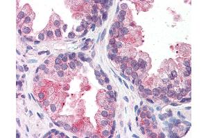 Immunohistochemistry (IHC) image for anti-SWI/SNF Related, Matrix Associated, Actin Dependent Regulator of Chromatin, Subfamily D, Member 2 (SMARCD2) (AA 431-480) antibody (ABIN6746995)