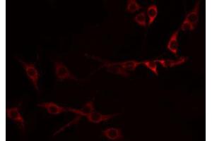 ABIN6274321 staining Hela by IF/ICC. (CD137 antibody  (Internal Region))