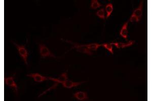 ABIN6274321 staining Hela by IF/ICC. (CD137 antibody  (Internal Region))