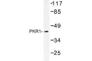 Image no. 1 for anti-Protein Kinase, CAMP-Dependent, Regulatory, Type I, alpha (Tissue Specific Extinguisher 1) (PRKAR1A) antibody (ABIN317770) (PRKAR1A antibody)