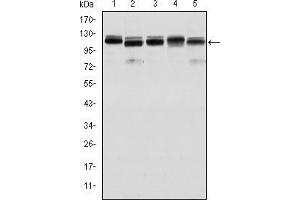 BMPR2 antibody