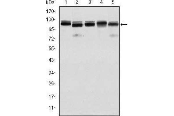 BMPR2 antibody