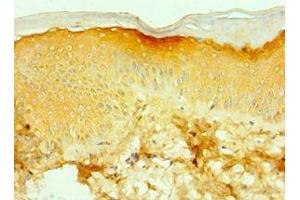 Immunohistochemistry of paraffin-embedded human skin tissue using ABIN7171754 at dilution of 1:100 (TNXB antibody  (AA 3933-4242))