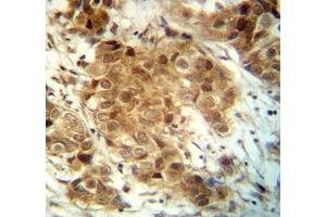 Immunohistochemistry (IHC) image for anti-Forkhead Box O3 (FOXO3) (AA 1-30) antibody (ABIN3030990)