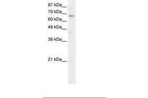 Image no. 1 for anti-Hairless (HR) (AA 170-219) antibody (ABIN6736046) (Hairless antibody  (AA 170-219))