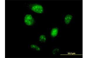 Immunofluorescence of purified MaxPab antibody to LOC148203 on HeLa cell. (ZNF738 antibody  (AA 1-137))