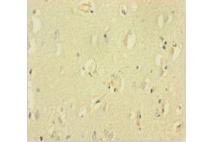 GABRQ antibody  (AA 348-611)