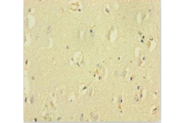 GABRQ antibody  (AA 348-611)