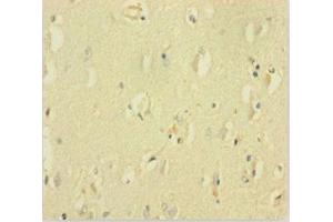 Immunohistochemistry of paraffin-embedded human brain tissue using ABIN7153507 at dilution of 1:100 (GABRQ antibody  (AA 348-611))