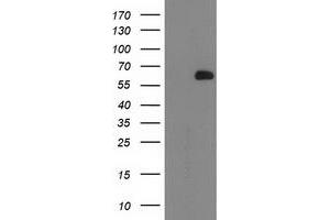 Western Blotting (WB) image for anti-2-Oxoglutarate and Iron-Dependent Oxygenase Domain Containing 1 (OGFOD1) antibody (ABIN1499912) (OGFOD1 antibody)