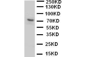 Anti-P2RX7 antibody, Western blottingWB: U87 Cell Lysate