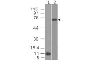Image no. 1 for anti-B-Cell CLL/lymphoma 6 (BCL6) (AA 200-401) antibody (ABIN5027051) (BCL6 antibody  (AA 200-401))